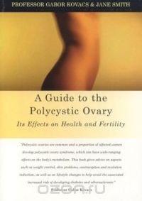 A Guide to the Polycystic Ovary: Its Effect on Health and Fertility