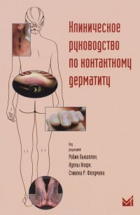 Клиническое руководство по контактному дерматиту. Диагностика и лечение в зависимости от области поражения