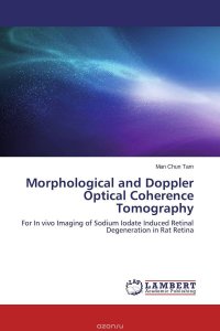 Morphological and Doppler Optical Coherence Tomography