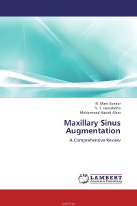 Maxillary Sinus Augmentation