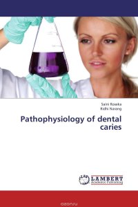 Pathophysiology of dental caries