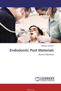 Endodontic Post Materials