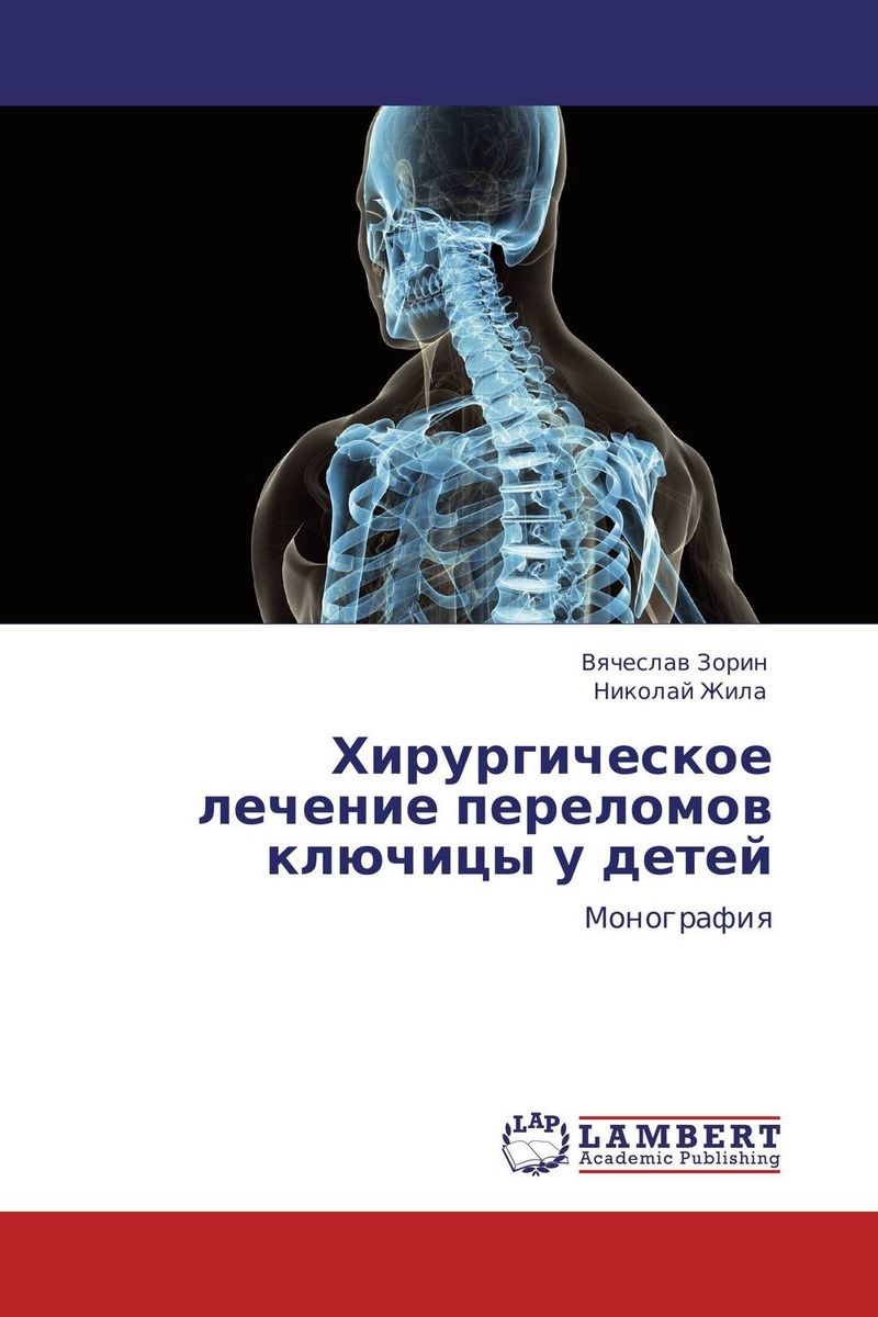 Хирургическое лечение переломов ключицы у детей