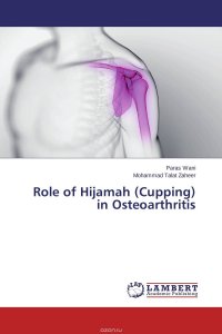 Role of Hijamah (Cupping) in Osteoarthritis