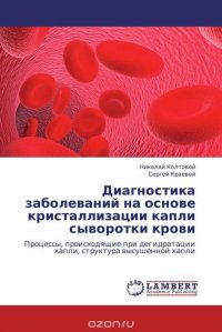 Диагностика заболеваний на основе кристаллизации капли сыворотки крови