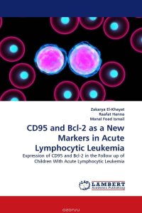 CD95 and Bcl-2 as a New Markers in Acute Lymphocytic Leukemia