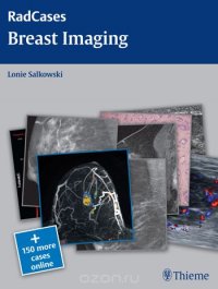 Breast Imaging