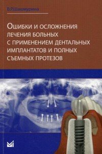 Ошибки и осложнения лечения больных с применением дентальных имплантов и полных съемных протезов