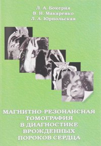 Магнитно-резонансная томография в диагностике врожденных пороков сердца