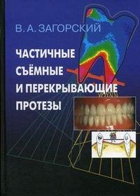 Частичные съемные и перекрывающие протезы