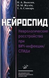 Нейроспид. Неврологические расстройства при ВИЧ-инфекции/СПИДе