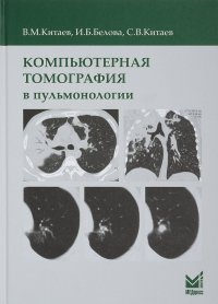 Компьютерная томография в пульмонологии