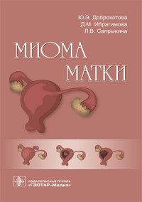 Ю. Э. Доброхотова - «Миома матки. Руководство»