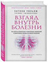 Взгляд внутрь болезни. Все секреты хронических и таинственных заболеваний и эффективные способы их полного исцеления (2-е издание)