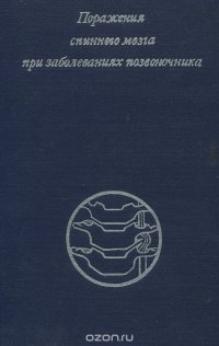 Поражения спинного мозга при заболеваниях позвоночника