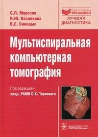 Мультиспиральная компьютерная томография