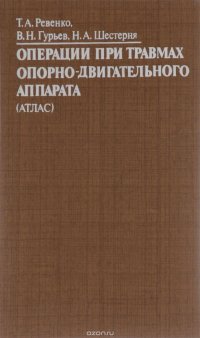 Операции при травмах опорно-двигательного аппарата