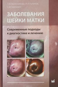 Заболеания шейки матки. Современные подходы к диагностике и лечению