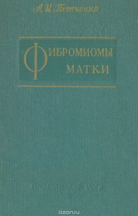 Фибромиомы матки