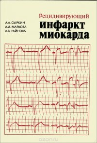 Рецидивирующий инфаркт миокарда