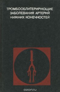 Тромбооблитерирующие заболевания артерий нижних конечностей