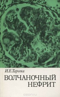 Волчаночный нефрит