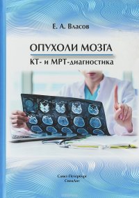 Опухоли мозга  КТ- и МРТ- диагностика