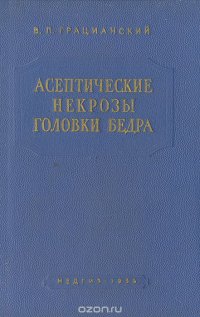 Асептические некрозы головки бедра (остеохондропатии)