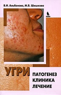 Угри. Патогенез. Клиника. Лечение