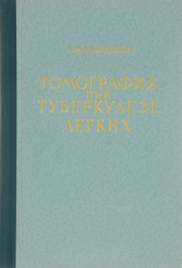 Томография при туберкулезе легких