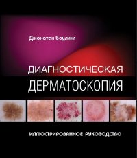 Диагностическая дерматоскопия