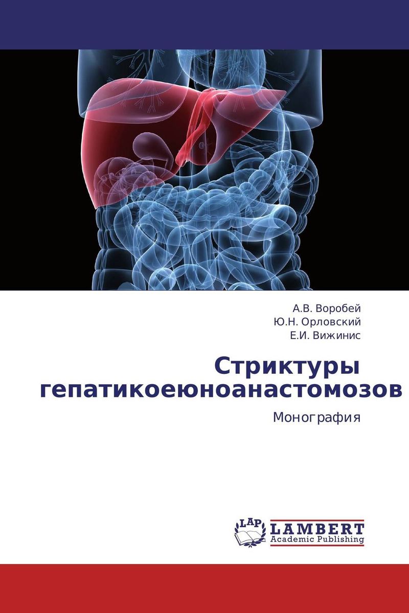 Стриктуры гепатикоеюноанастомозов