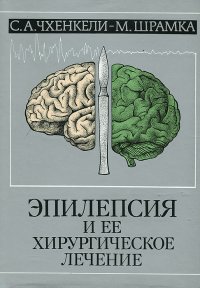 Эпилепсия и ее хирургическое лечение