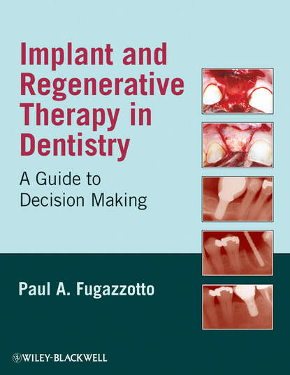 Implant and Regenerative Therapy in Dentistry