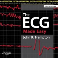 The ECG Made Easy