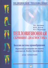 Тепловизионная скрининг-диагностика. Болезни системы кровообращения. Варикозное расширение вен