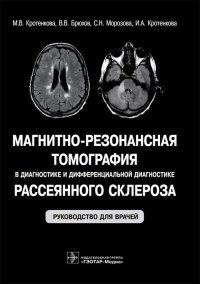 Магнитно-резонансная томография в диагностике и дифференциальной диагностике рассеянного склероза. Руководство для врачей