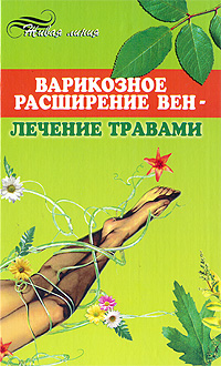 Варикозное расширение вен - лечение травами