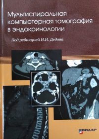 Мультиспиральная компьютерная томография в эндокринологии