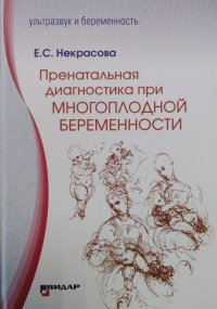 Пренатальная диагностика при многоплодной беременности