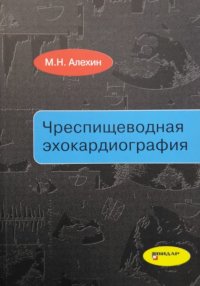 Чреспищеводная эхокардиография