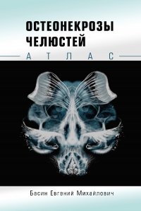 Остеонекрозы челюстей. Атлас