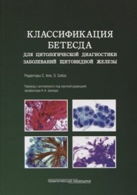 Классификация Бетесда для цитологической диагностики заболеваний щитовидной железы: терминология, критерии и пояснения