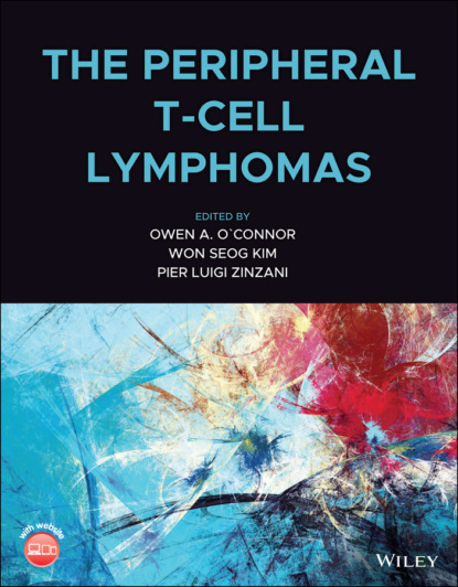 The Peripheral T-Cell Lymphomas