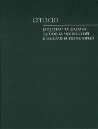 Ю. И. Воробьев, М. В. Котельников, И. А. Шехтер - «Атлас рентгенограмм зубов и челюстей в норме и патологии»