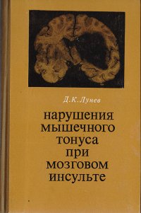 Нарушения мышечного тонуса при мозговом инсульте