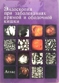 Эндоскопия при заболеваниях прямой и ободочной кишки. Атлас