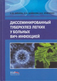 Диссеминированный туберкулез легких у больных ВИЧ-инфекцией