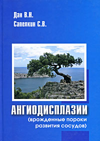 Ангиодисплазии (врожденные пороки развития сосудов)