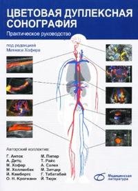 Цветовая дуплексная сонография